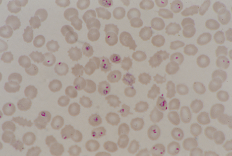 Plasmodium falciparum