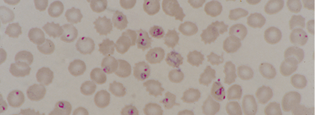 Plasmodium falciparum